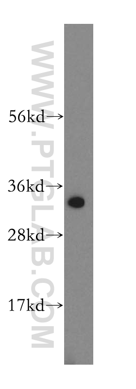 16888-1-AP;HeLa cells