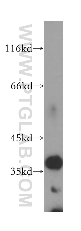 13742-1-AP;human brain tissue