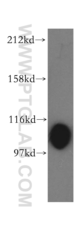 16113-1-AP;HepG2 cell