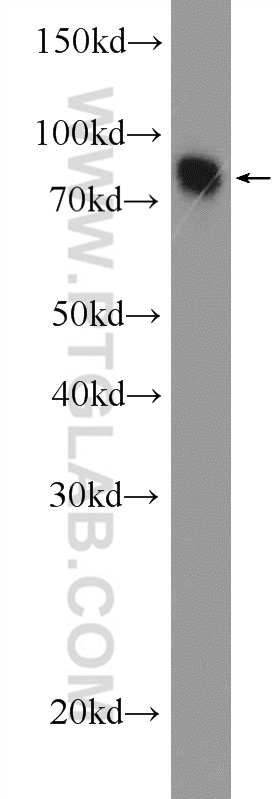 25990-1-AP;mouse brain tissue