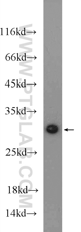 11610-1-AP;mouse heart tissue