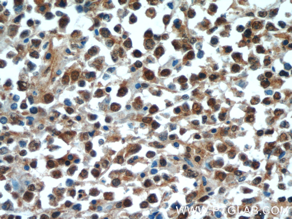 10828-1-AP;human lymphoma tissue