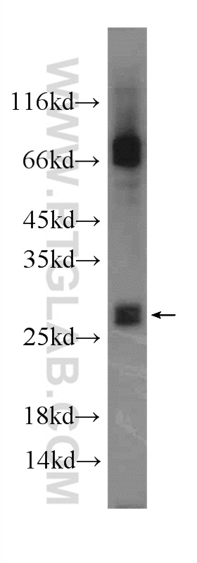 22004-1-AP;mouse spleen tissue