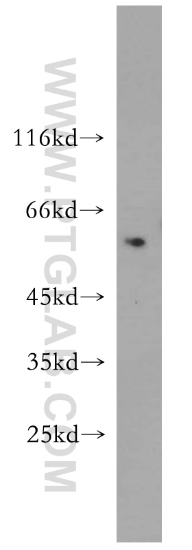 11151-1-AP;SGC-7901 cell