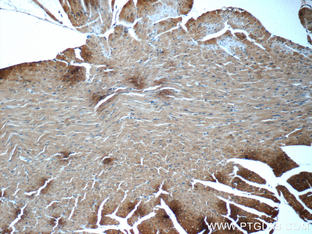 22280-1-AP;mouse heart tissue