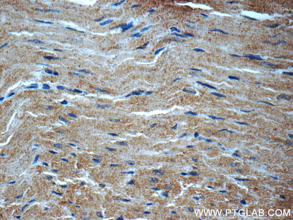 22280-1-AP;mouse heart tissue