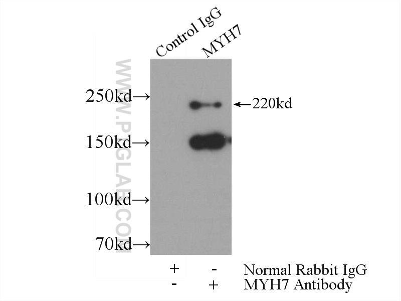 22280-1-AP;mouse heart tissue