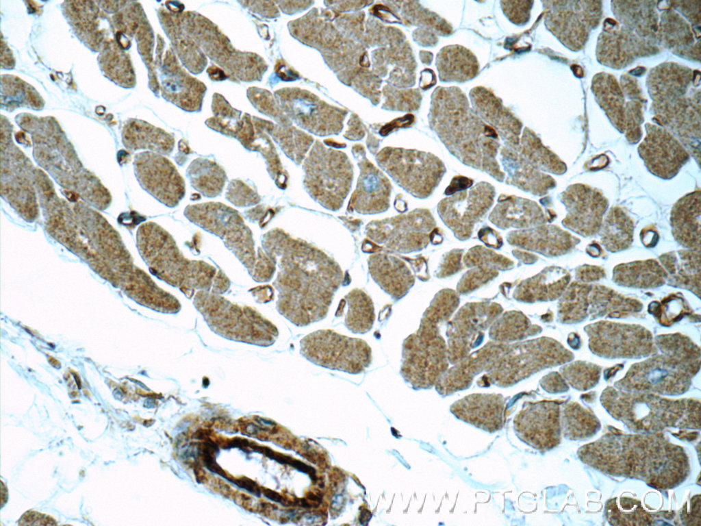 16287-1-AP;human heart tissue