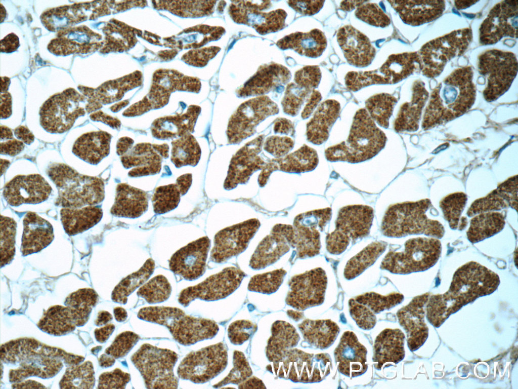 55462-1-AP;human heart tissue