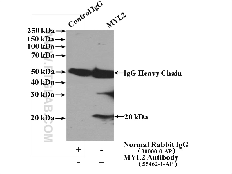 55462-1-AP;mouse brain tissue