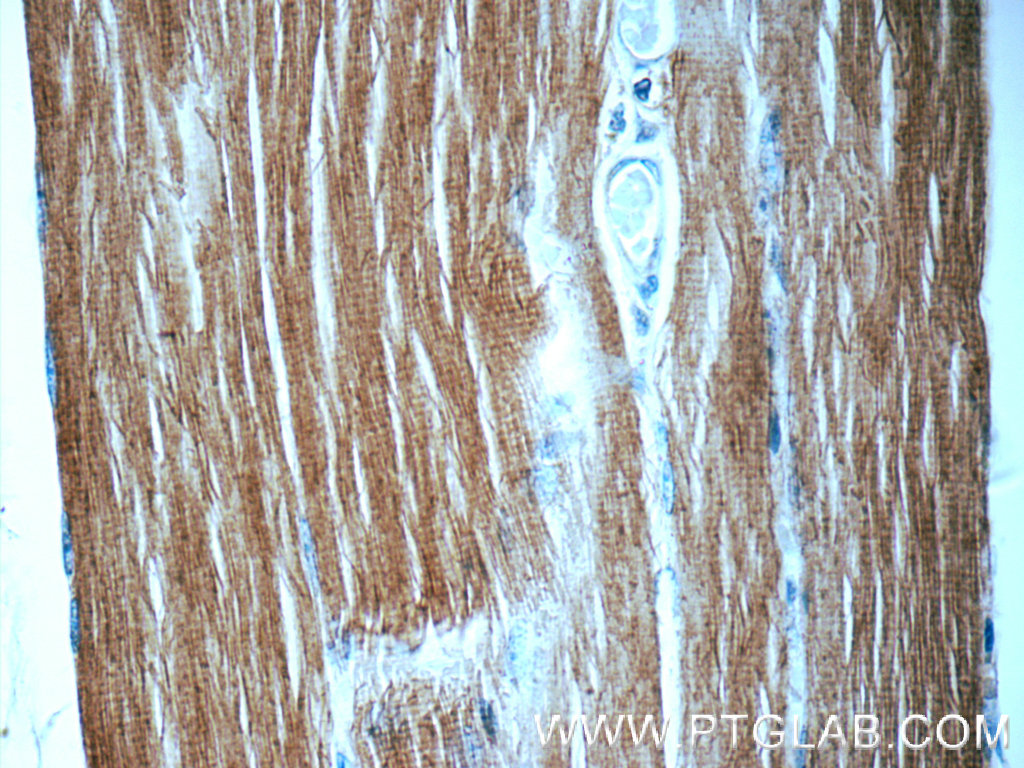 16052-1-AP;human skeletal muscle tissue