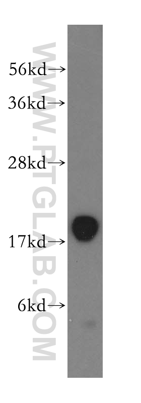 16052-1-AP;mouse skeletal muscle tissue