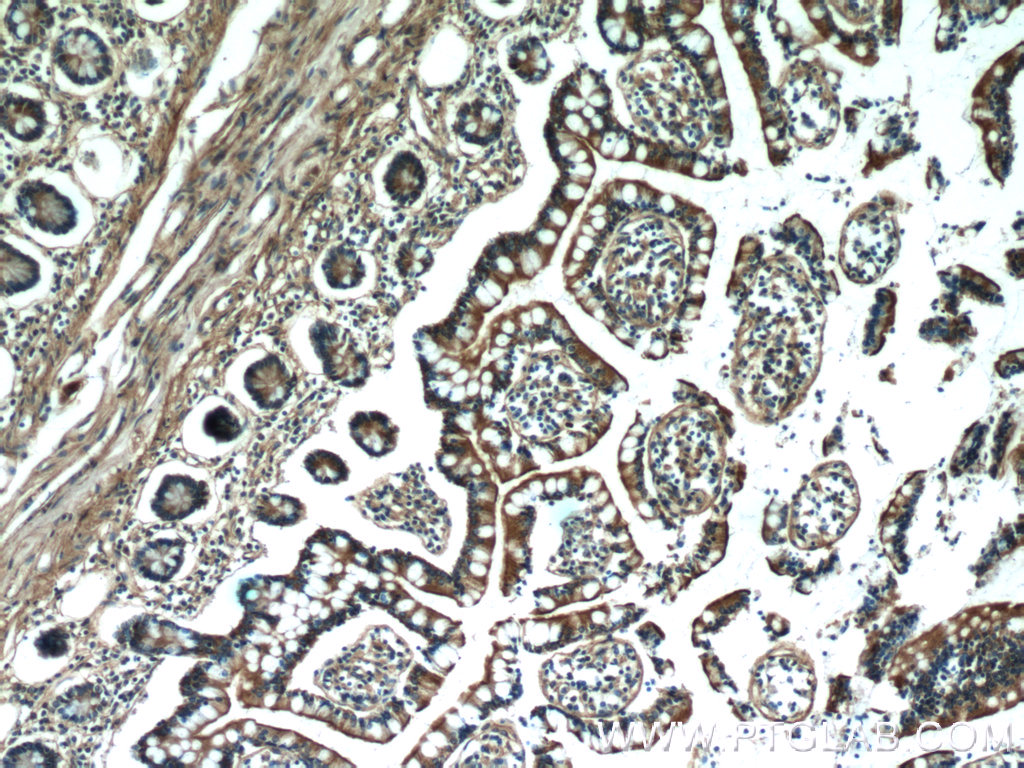 17499-1-AP;human small intestine tissue