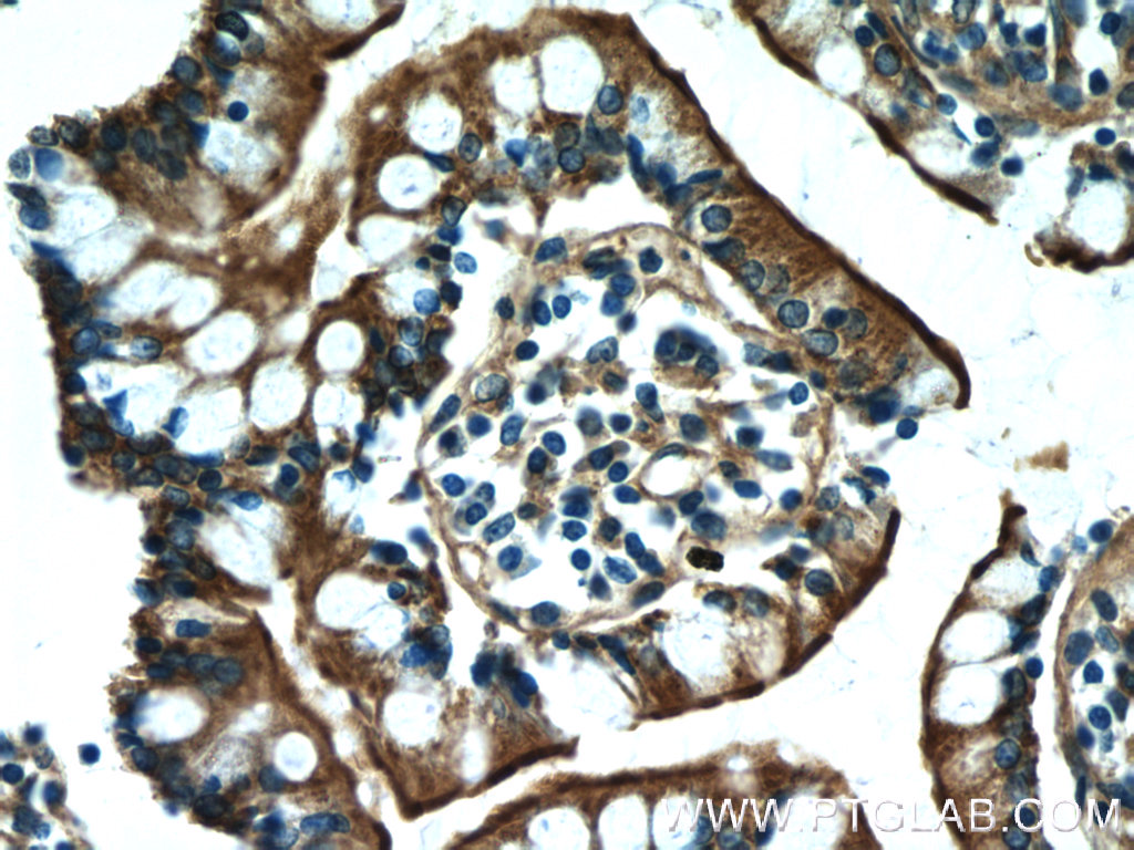 17499-1-AP;human small intestine tissue