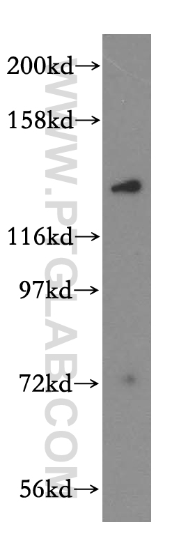 17499-1-AP;mouse brain tissue