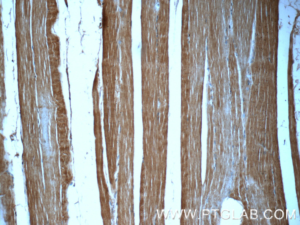 20360-1-AP;human skeletal muscle tissue