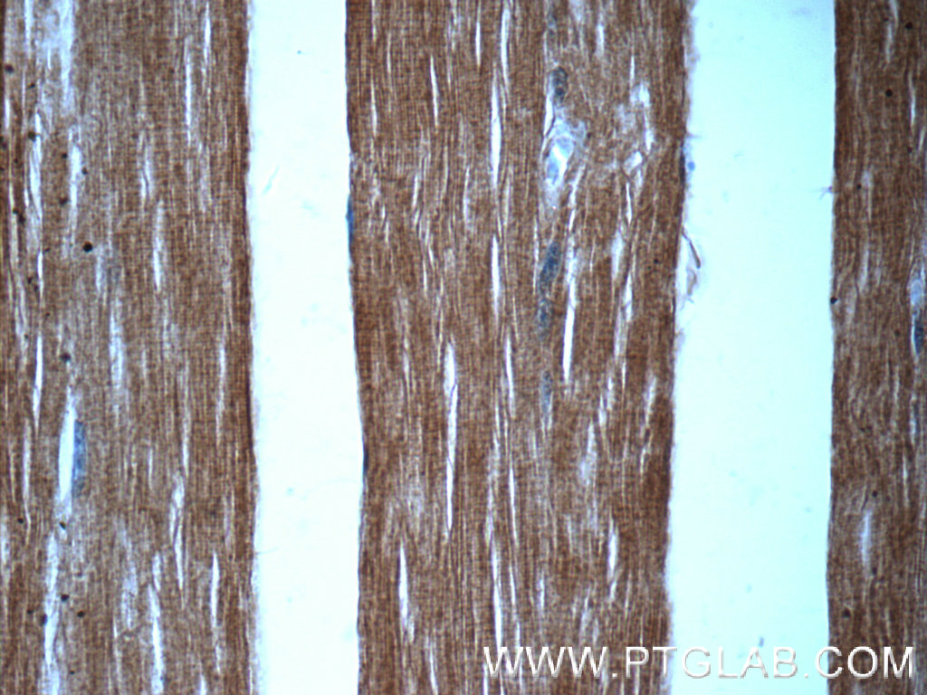 20360-1-AP;human skeletal muscle tissue