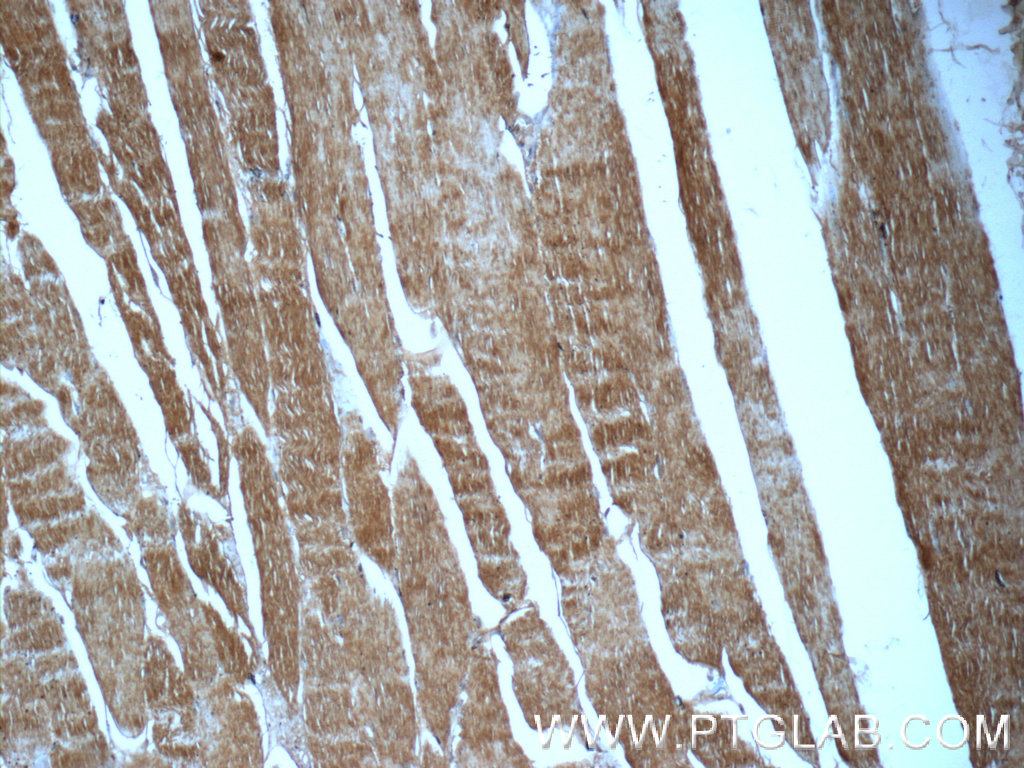 16180-1-AP;human skeletal muscle tissue