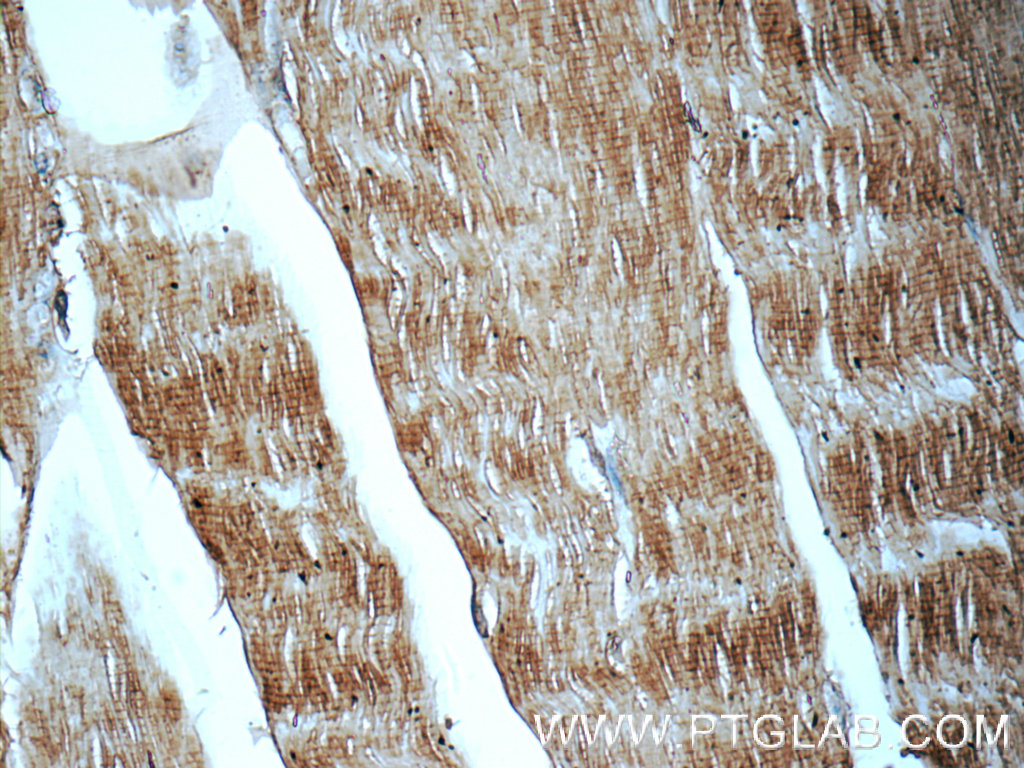 16180-1-AP;human skeletal muscle tissue