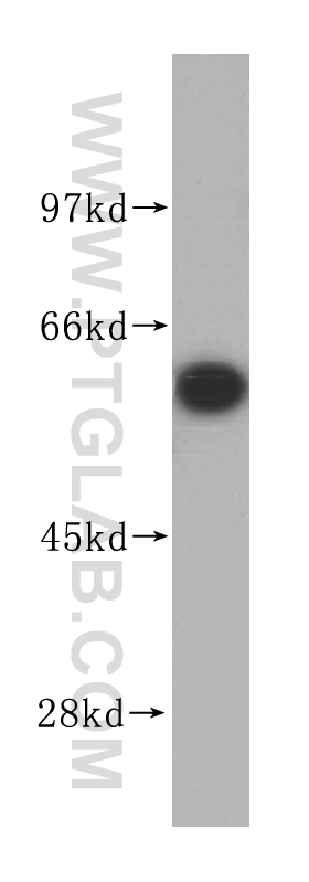 14882-1-AP;HepG2 cell