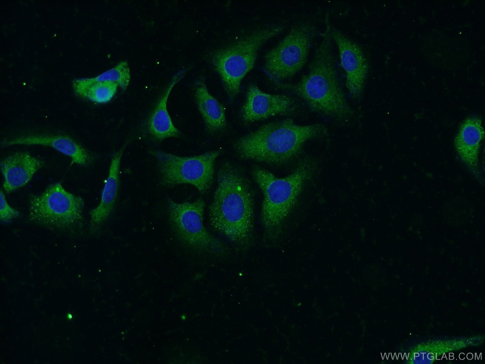 14683-1-AP;SH-SY5Y cells