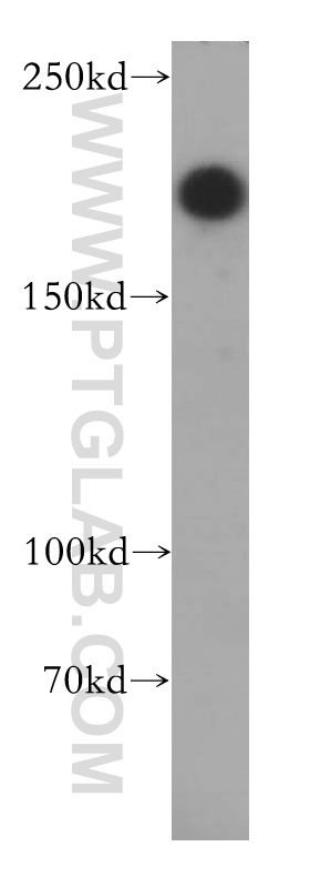 14683-1-AP;SH-SY5Y cells