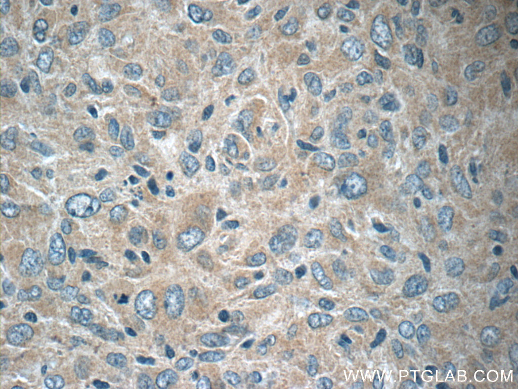 12140-1-AP;human gliomas tissue