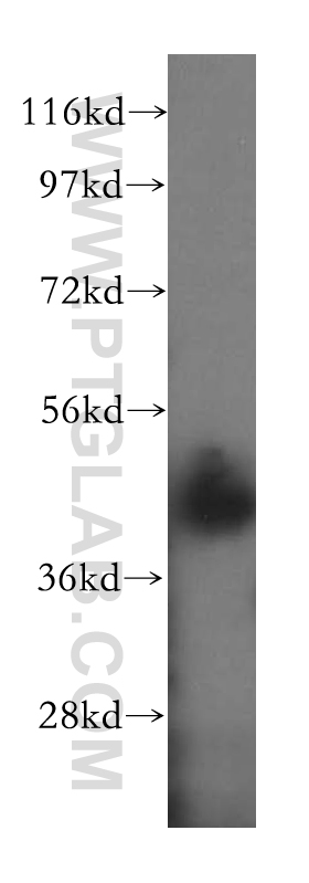 17262-1-AP;human brain tissue