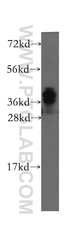 12184-1-AP;human brain tissue