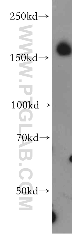 20246-1-AP;human brain tissue