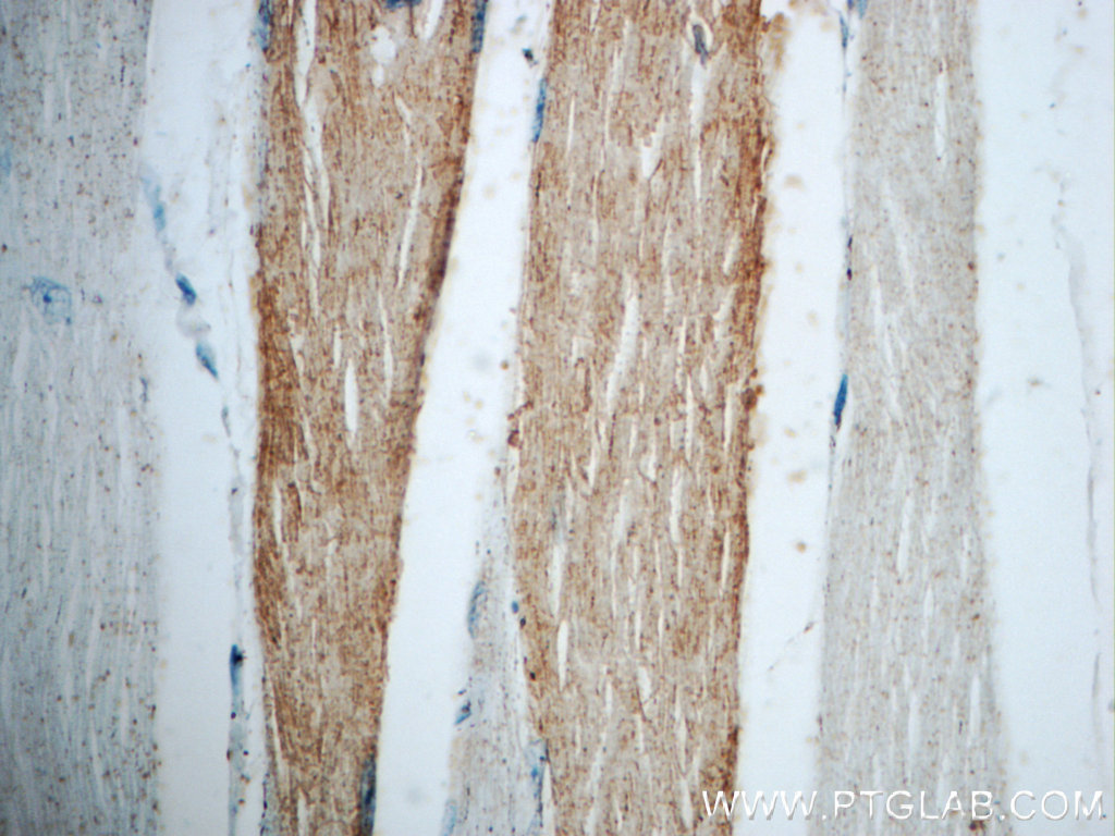 21263-1-AP;human skeletal muscle