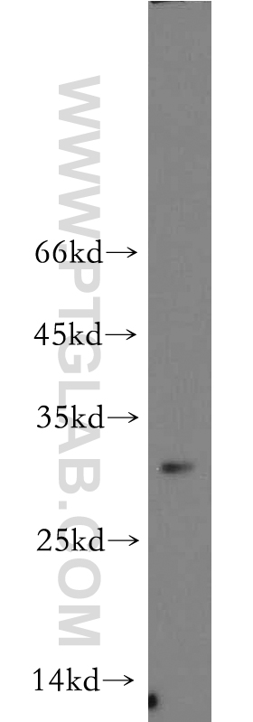 21263-1-AP;HL-60 cell