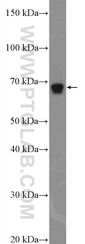 10659-1-AP;mouse kidney tissue