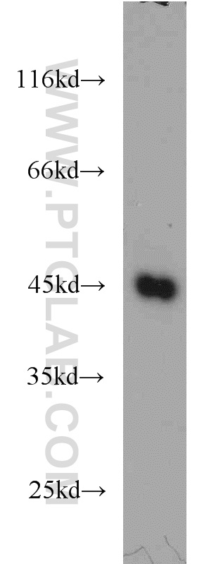 11089-1-AP;K-562 cells