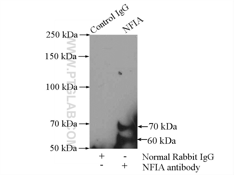 11750-1-AP;A431 cells