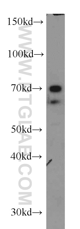 11750-1-AP;A431 cell