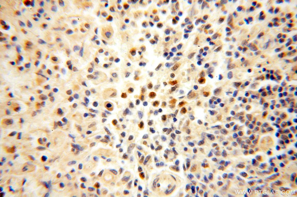 15503-1-AP;human spleen tissue