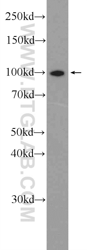 15503-1-AP;A431 cells