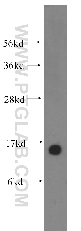 13499-1-AP;human brain tissue