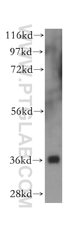 16524-1-AP;human cerebellum tissue