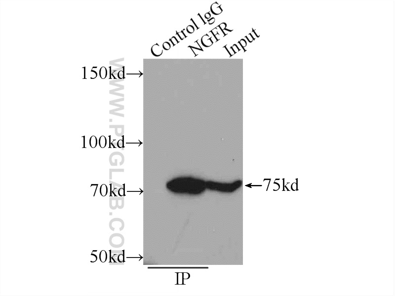 55014-1-AP;mouse brain tissue