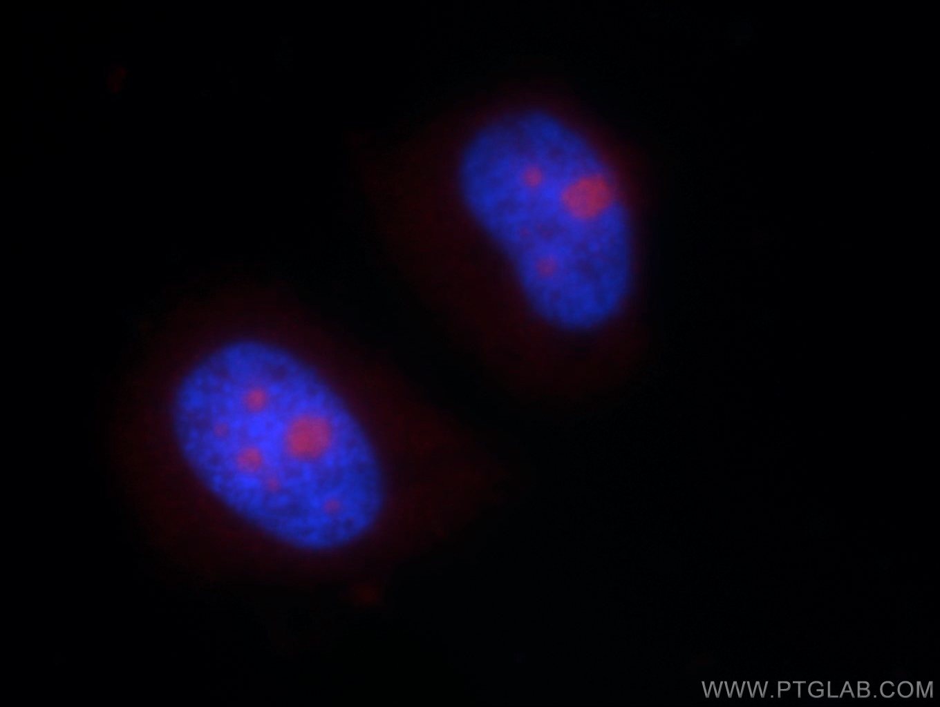 15802-1-AP;HeLa cells