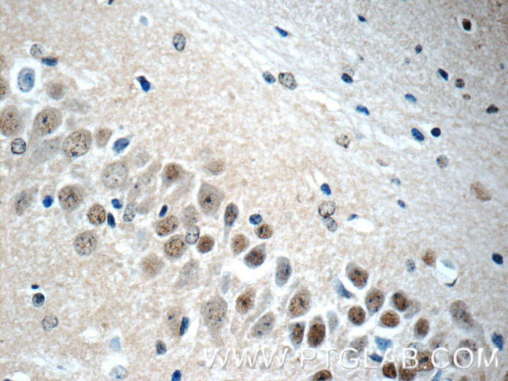 15802-1-AP;mouse brain tissue