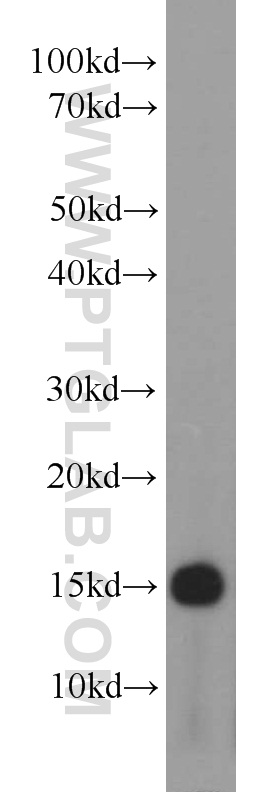 15802-1-AP;HeLa cells