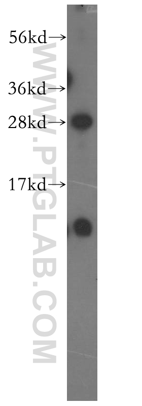 11789-1-AP;human brain tissue