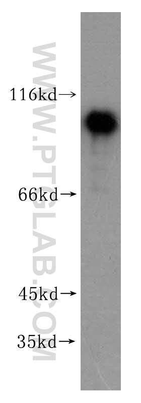 14693-1-AP;Jurkat cells