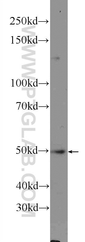 16419-1-AP;BxPC-3 cells