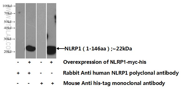 12256-1-AP;Transfected HEK-293 cells