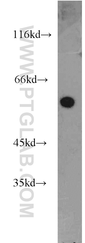 16060-1-AP;HepG2 cells