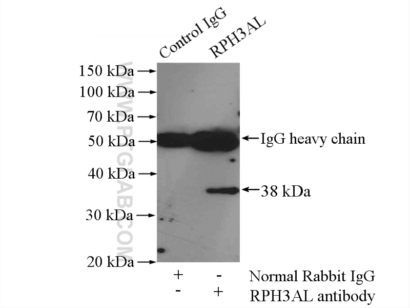 15297-1-AP;HepG2 cells